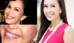 Làm trắng răng bằng photoshop chưa đến 60 giây